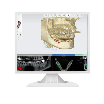 75mm HDMI VGA 17inch LED Computer Monitor 4:3 Square PC Monitor